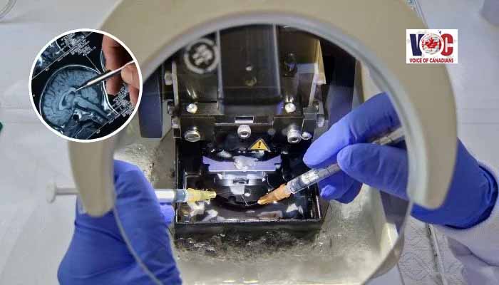 Is human brain preservation possible? New study brings it closer